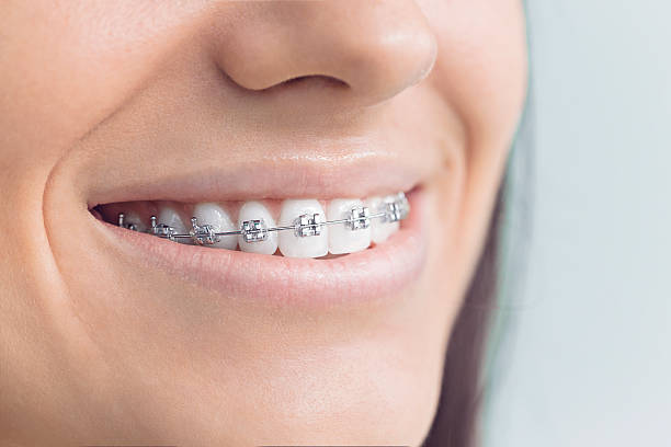 Best Traditional Braces  in Esperance, WA